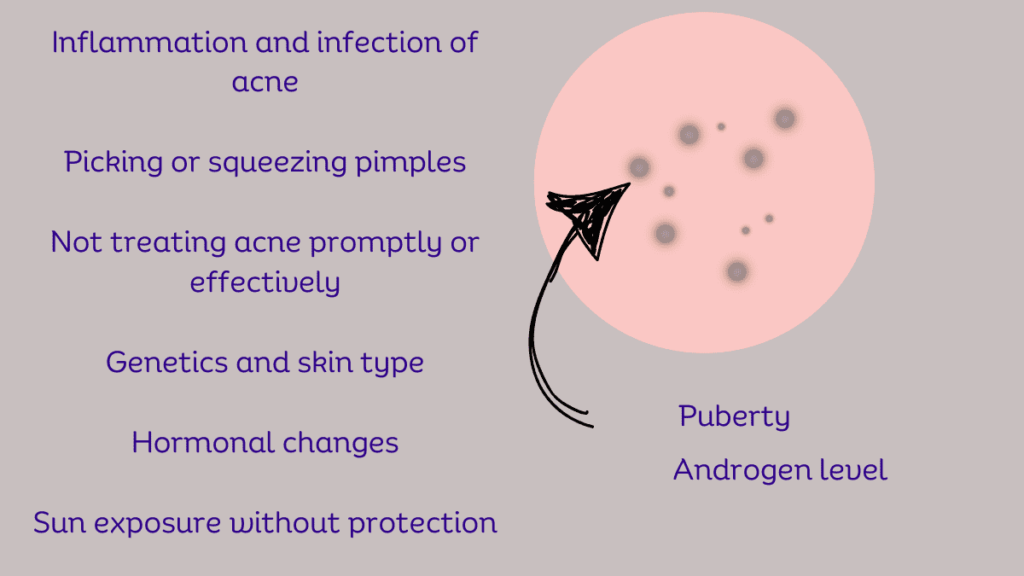 Natural Remedies for Acne Scars Causes